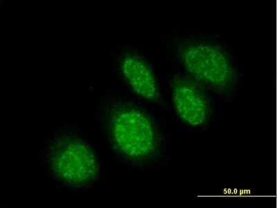 Immunocytochemistry/ Immunofluorescence: RBBP9 Antibody [H00010741-B01P]