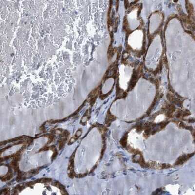 Immunohistochemistry-Paraffin: RBBP9 Antibody [NBP1-88553]