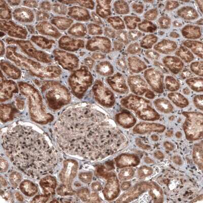 Immunohistochemistry-Paraffin: RBCK1 Antibody (CL4289) [NBP2-59048]
