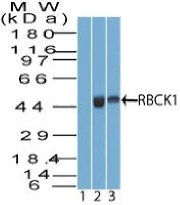 Western Blot: RBCK1 Antibody [NBP2-27105]