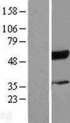 Western Blot: RBCK1 Overexpression Lysate [NBL1-15187]