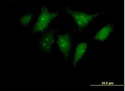 Immunocytochemistry/ Immunofluorescence: RBED1 Antibody [H00084173-B01P]