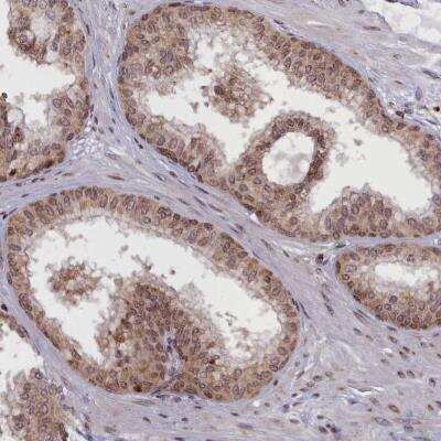 Immunohistochemistry-Paraffin: RBEL1 Antibody [NBP1-91741]