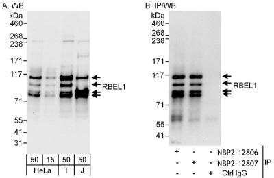 Immunoprecipitation: RBEL1 Antibody [NBP2-12807]