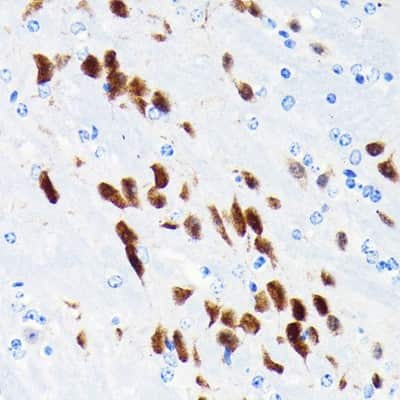 Immunohistochemistry-Paraffin: RBFOX3/NeuN Antibody (2F9F0) [NBP3-15656]