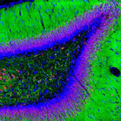 Immunocytochemistry/ Immunofluorescence: RBFOX3/NeuN Antibody [NBP3-05554]
