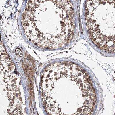 Immunohistochemistry-Paraffin: RBJ Antibody [NBP1-80857]