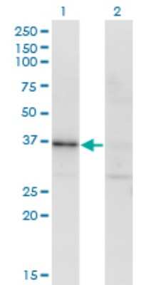 Western Blot: RBKS Antibody (3B4) [H00064080-M01]
