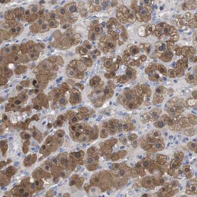 Immunohistochemistry: RBKS Antibody [NBP1-84116]