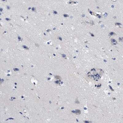 Immunohistochemistry-Paraffin: RBKS Antibody [NBP1-84116]