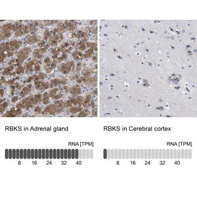 Immunohistochemistry-Paraffin: RBKS Antibody [NBP1-84116]