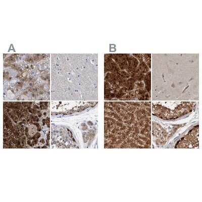Immunohistochemistry-Paraffin: RBKS Antibody [NBP1-84116]