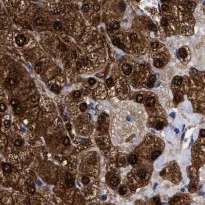 Immunohistochemistry-Paraffin: RBKS Antibody [NBP1-84116]