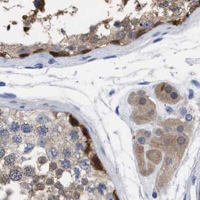 Immunohistochemistry-Paraffin: RBKS Antibody [NBP1-84116]