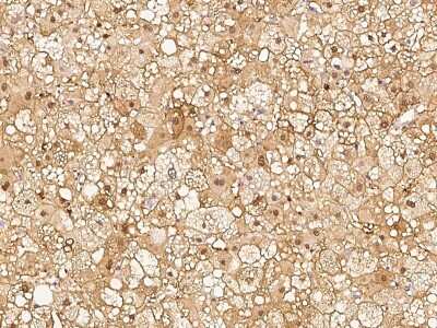 Immunohistochemistry-Paraffin: RBKS Antibody [NBP2-97078]