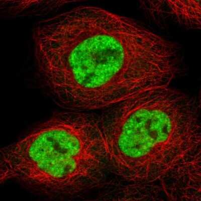 Immunocytochemistry/ Immunofluorescence: RBM10 Antibody [NBP1-84951]