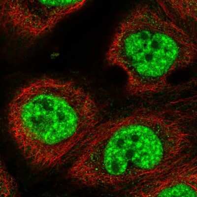 Immunocytochemistry/ Immunofluorescence: RBM10 Antibody [NBP2-56831]