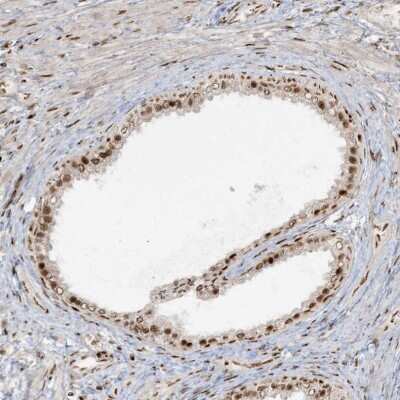 Immunohistochemistry-Paraffin: RBM10 Antibody [NBP1-84951]