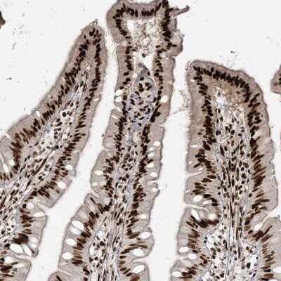 Immunohistochemistry-Paraffin: RBM10 Antibody [NBP1-84951]