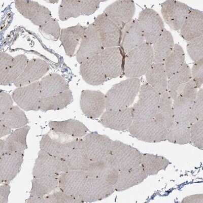 Immunohistochemistry-Paraffin: RBM10 Antibody [NBP1-84951]