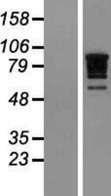 Western Blot: RBM10 Overexpression Lysate [NBL1-15194]