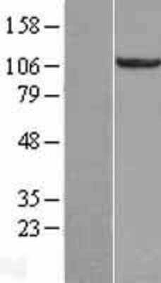 Western Blot: RBM10 Overexpression Lysate [NBL1-15195]