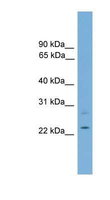 Western Blot: RBM11 Antibody [NBP1-57083]