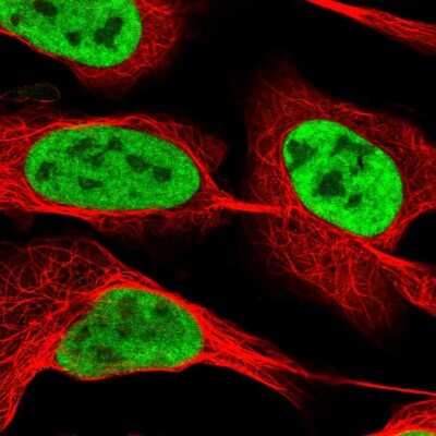 Immunocytochemistry/ Immunofluorescence: RBM12 Antibody [NBP2-13208]