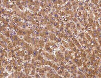 Immunohistochemistry-Paraffin: RBM12B Antibody [NBP3-12629]
