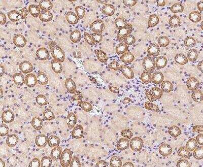 Immunohistochemistry-Paraffin: RBM12B Antibody [NBP3-12629]