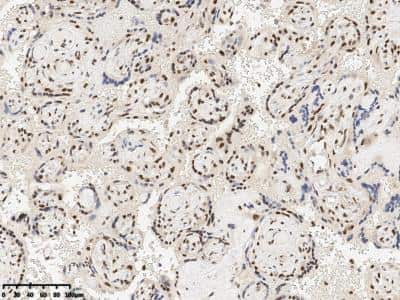 Immunohistochemistry: RBM14 Antibody [NBP3-14796]