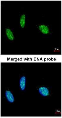 Immunocytochemistry/ Immunofluorescence: RBM15 Antibody [NBP1-31364]
