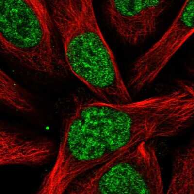 Immunocytochemistry/ Immunofluorescence: RBM15 Antibody [NBP1-82465]
