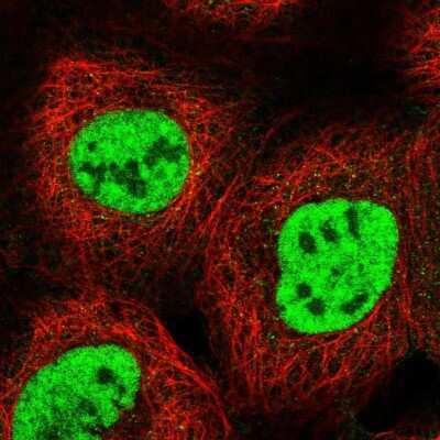 Immunocytochemistry/ Immunofluorescence: RBM15 Antibody [NBP2-56787]