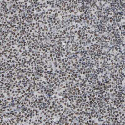 Immunohistochemistry-Paraffin: RBM15 Antibody [NBP1-82465]