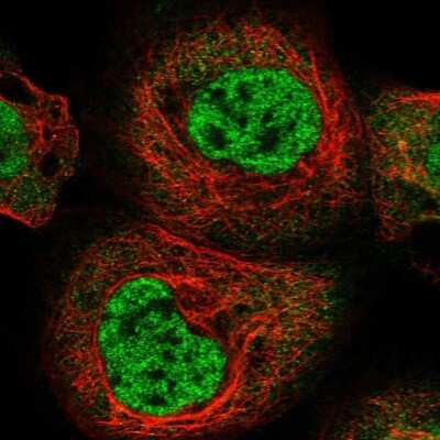 Immunocytochemistry/ Immunofluorescence: RBM15B Antibody [NBP1-81650]