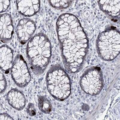 Immunohistochemistry-Paraffin: RBM15B Antibody [NBP1-81650]