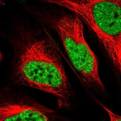 Immunocytochemistry/ Immunofluorescence: RBM17 Antibody [NBP2-38348]