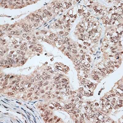 Immunohistochemistry-Paraffin: RBM17 Antibody - BSA Free [NBP2-94654]