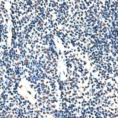 Immunohistochemistry-Paraffin: RBM17 Antibody - BSA Free [NBP2-94654]