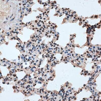 Immunohistochemistry-Paraffin: RBM17 Antibody - BSA Free [NBP2-94654]