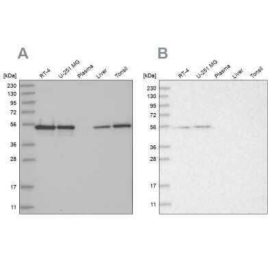 Western Blot: RBM17 Antibody [NBP2-38348]