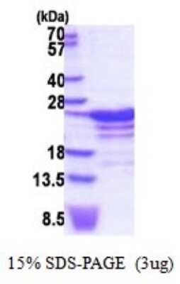 SDS-PAGE: Recombinant Human RBM18 His Protein [NBP2-51867]