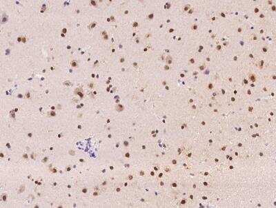 Immunohistochemistry-Paraffin: RBM19 Antibody [NBP3-12591]
