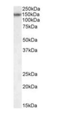 Western Blot: RBM20 Antibody [NBP2-27509]