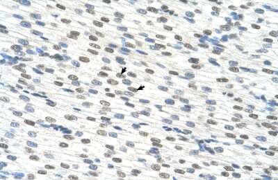 Immunohistochemistry-Paraffin: RBM22 Antibody [NBP1-57327]