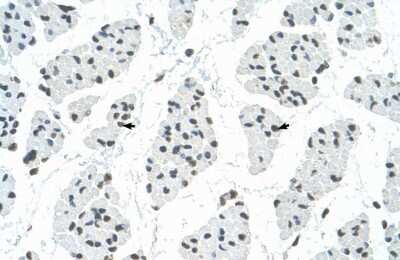 Immunohistochemistry-Paraffin: RBM22 Antibody [NBP1-57327]