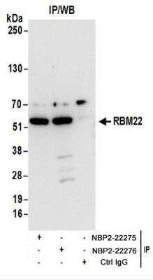 Immunoprecipitation: RBM22 Antibody [NBP2-22276]