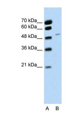 Western Blot: RBM22 Antibody [NBP1-57327]