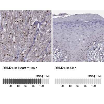 Immunohistochemistry-Paraffin: RBM24 Antibody [NBP2-57328]